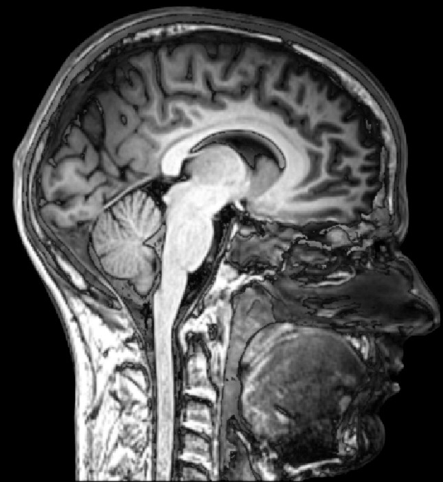 Janeiro Branco e o chamado à saúde mental coletiva em um mundo de assimetrias. Fotografia de um exame feito na área do cérebro