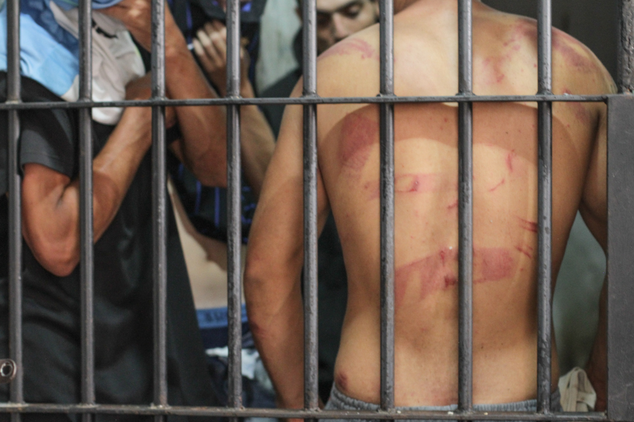 Foto de presos em um cárcere. Um deles está de costas para a grade, com diversas marcas nas costas
