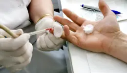 HIV