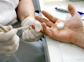 HIV