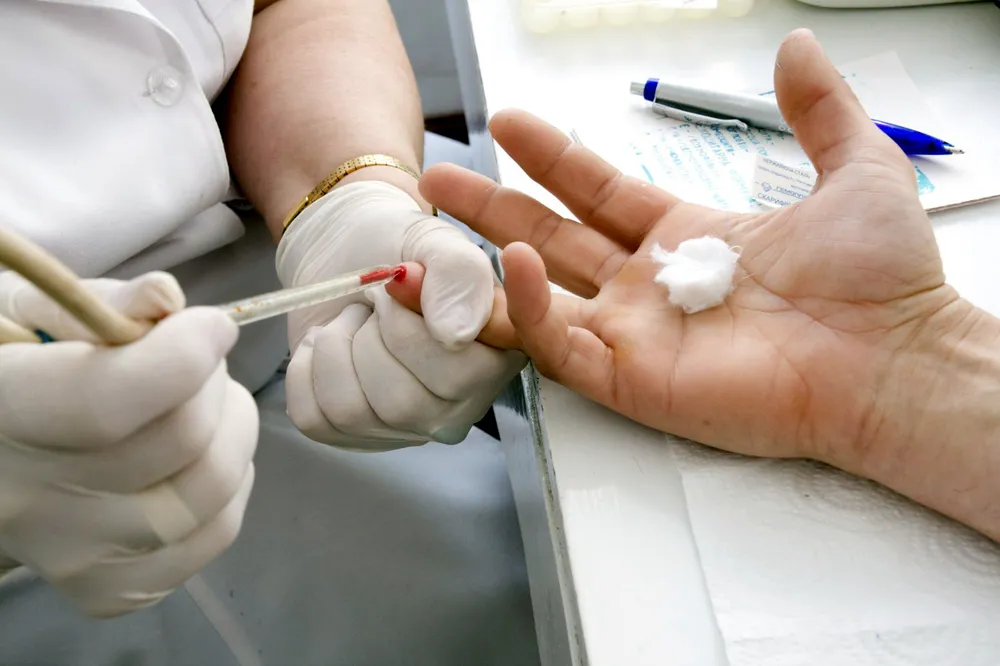 HIV